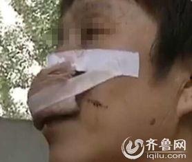 明星被咬掉舌头事件,明星遭遇咬舌惊魂事件