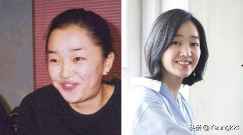 韩国整牙明星,见证美丽蜕变之路